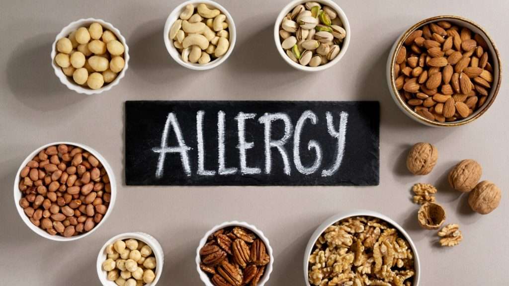 Online food allergy management certification badge for FAM303